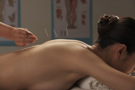 Acupuncture Kerry, Acupuncture For Lower Back Pain