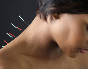 Acupuncture For Lower Back Pain