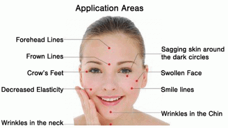 Cosmetic Acupuncture - Kerry Acupuncture