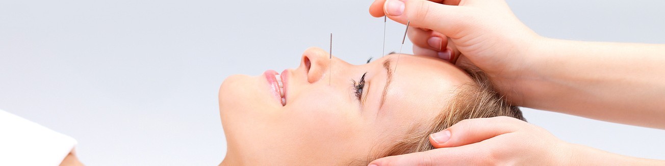 Acupuncture beauty Treatment in Tralee