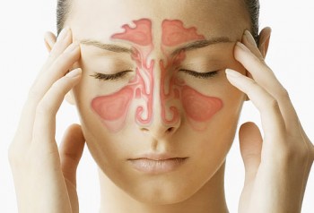 Acupuncture for Sinusitis kerry style