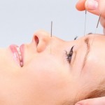 Tralee Acupuncture
